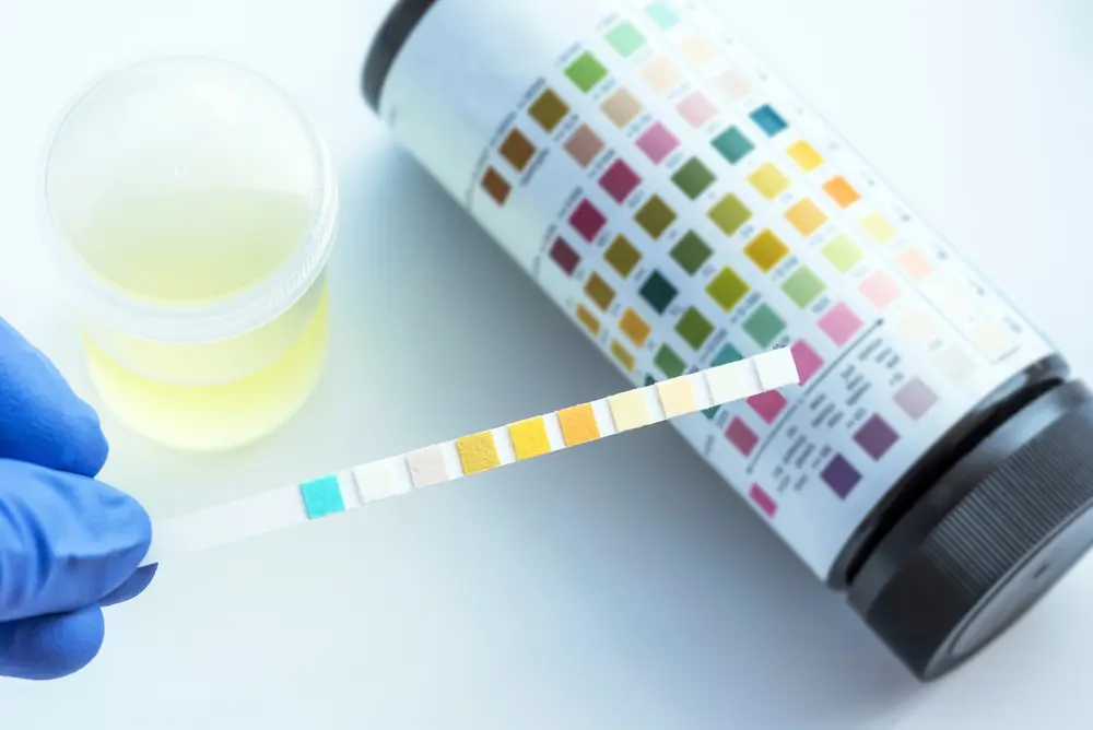 UTI symptoms of a UTI