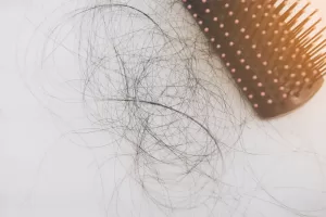 hair loss women 1 hair loss