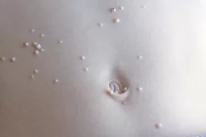 molluscum