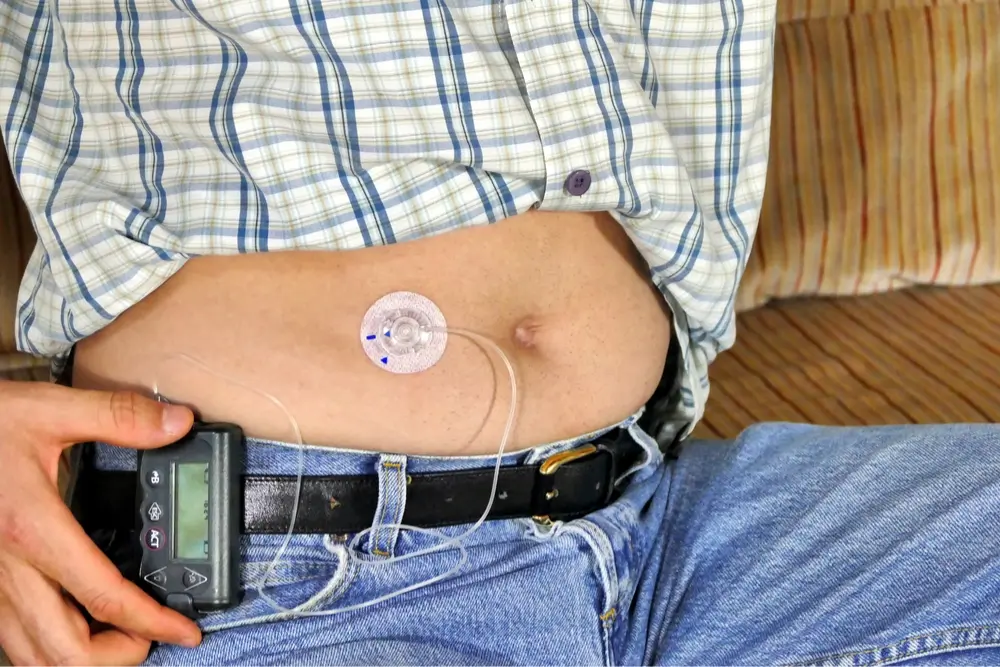 type 1 diabetes gastro