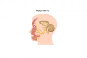 bells palsy 3 gastro