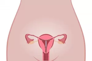 Can you get pregnant with a Mirena