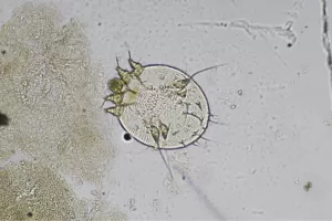 what is scabies?