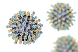 complications of measles