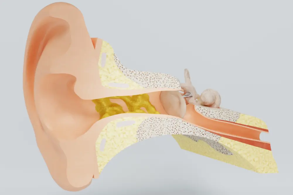 ear wax 2 what causes mouth ulcers? are mouth ulcers contagious?