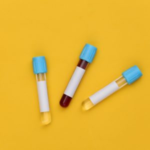 blood tests vials qoctor image Acid Reflux or GORD