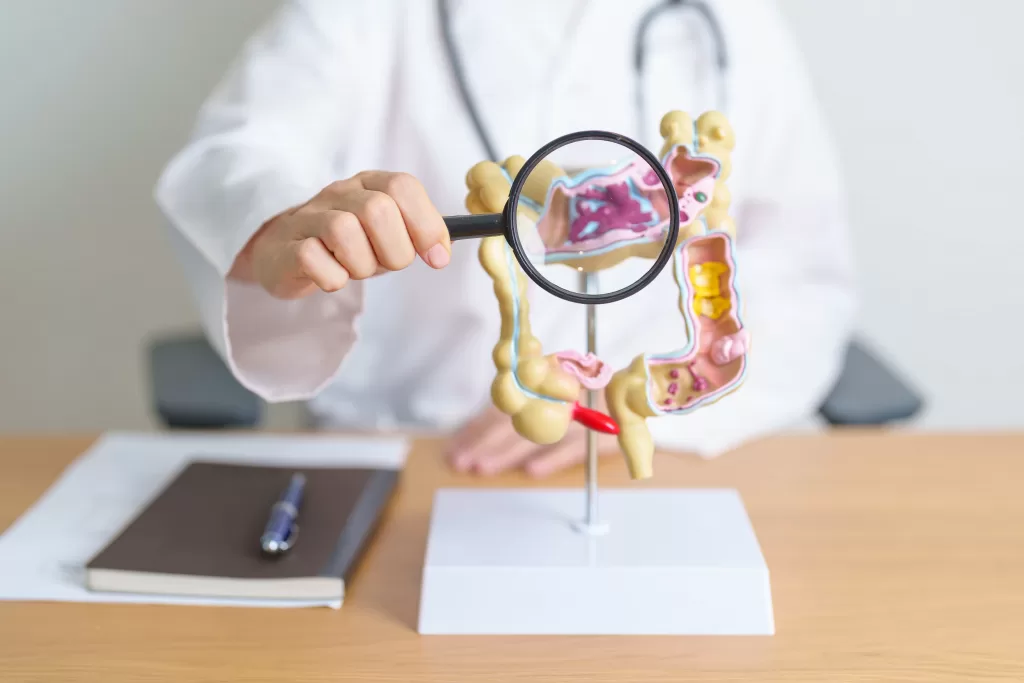 Doctor-showing-a-human-colon-anatomy-model-to-explain-where-ulcerative-colitis-occurs-scaled Doctor showing a human colon anatomy model to explain where ulcerative colitis occurs
