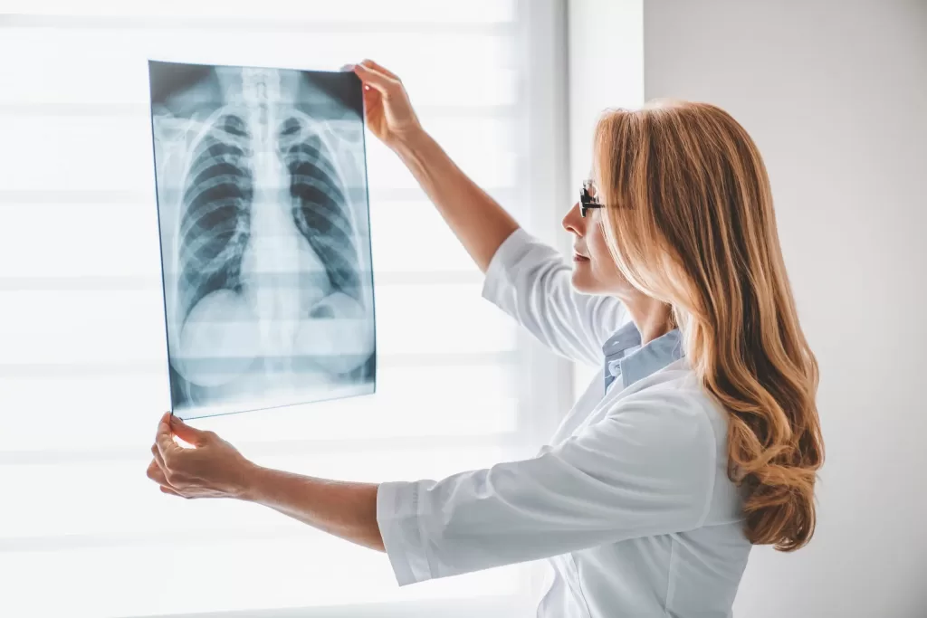 Female-doctor-looking-at-a-chest-x-ray-of-a-patient-with-pectus-excavatum-scaled Female doctor looking at a chest x-ray of a patient with pectus excavatum